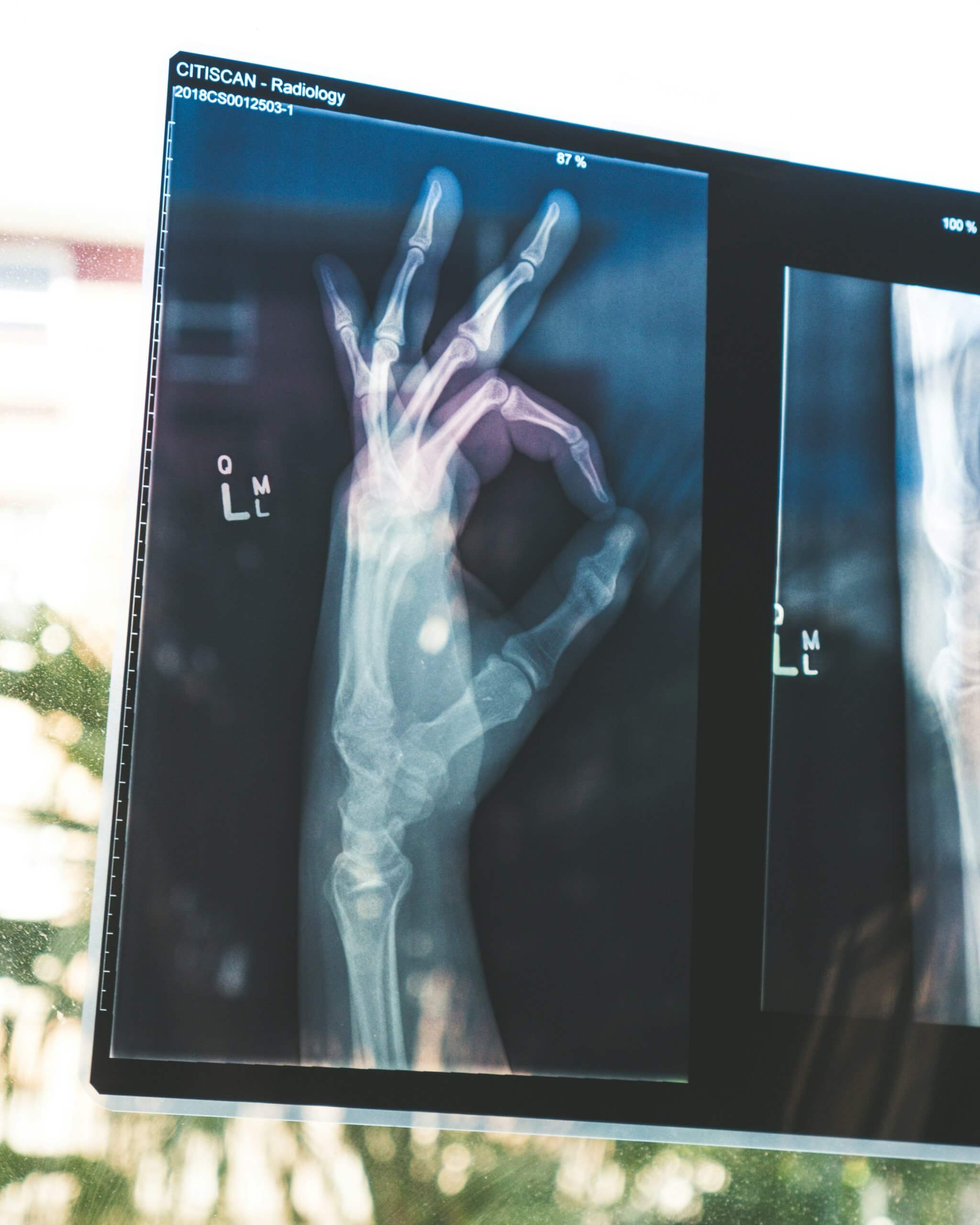 Using AI to Grow Medical Tourism